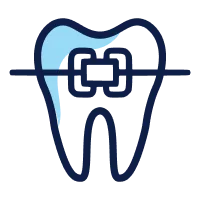 Invisalign® — Orthodontie, services et soins dentaires à Montréal-Ouest | Orthodontics, dental services and care in Montreal West — Avenue Dentaire